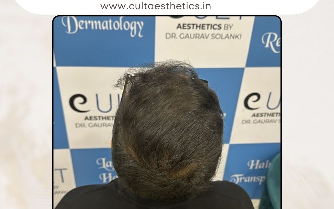 Hair Case 376 After 3