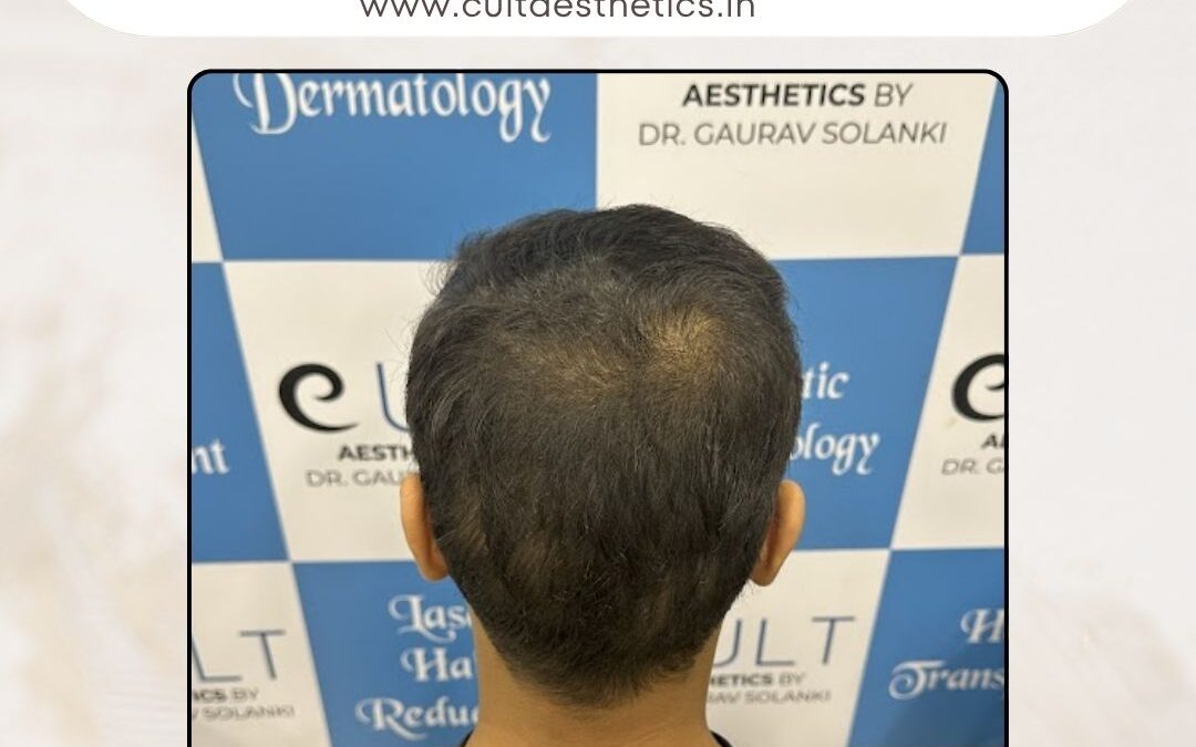 Hair Case 376 After 4