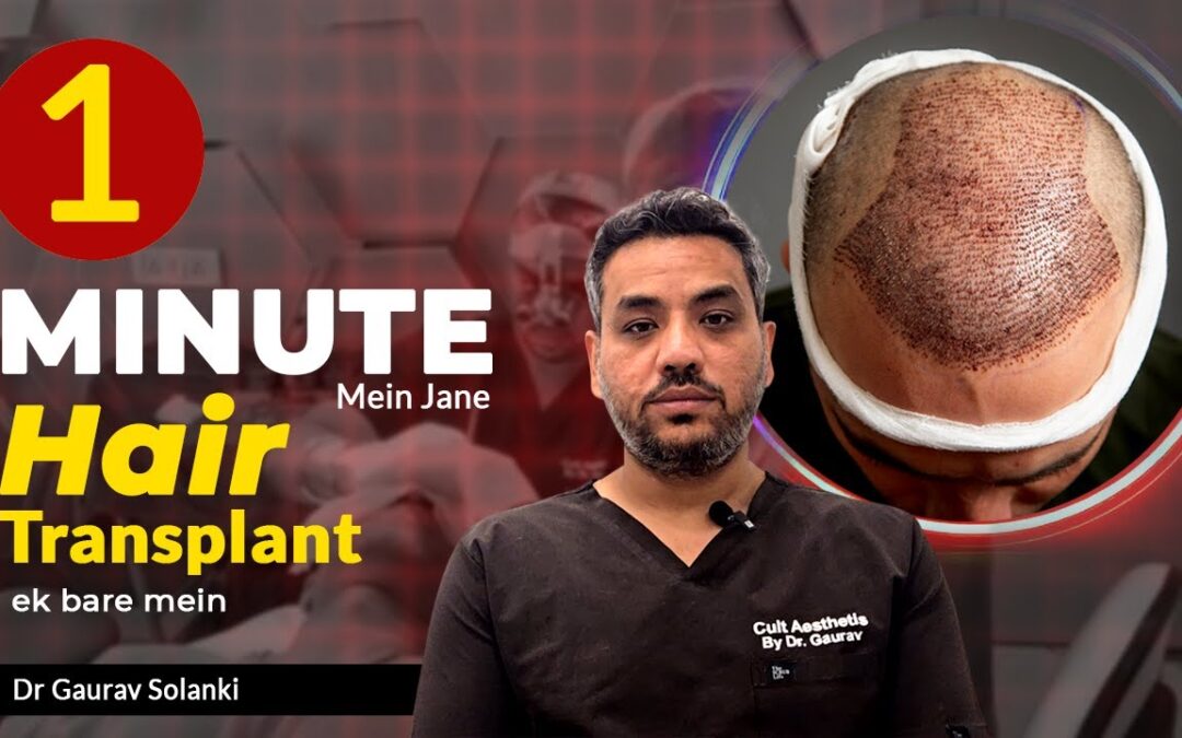 Everything You Need to Know About Hair Transplant in One Minute