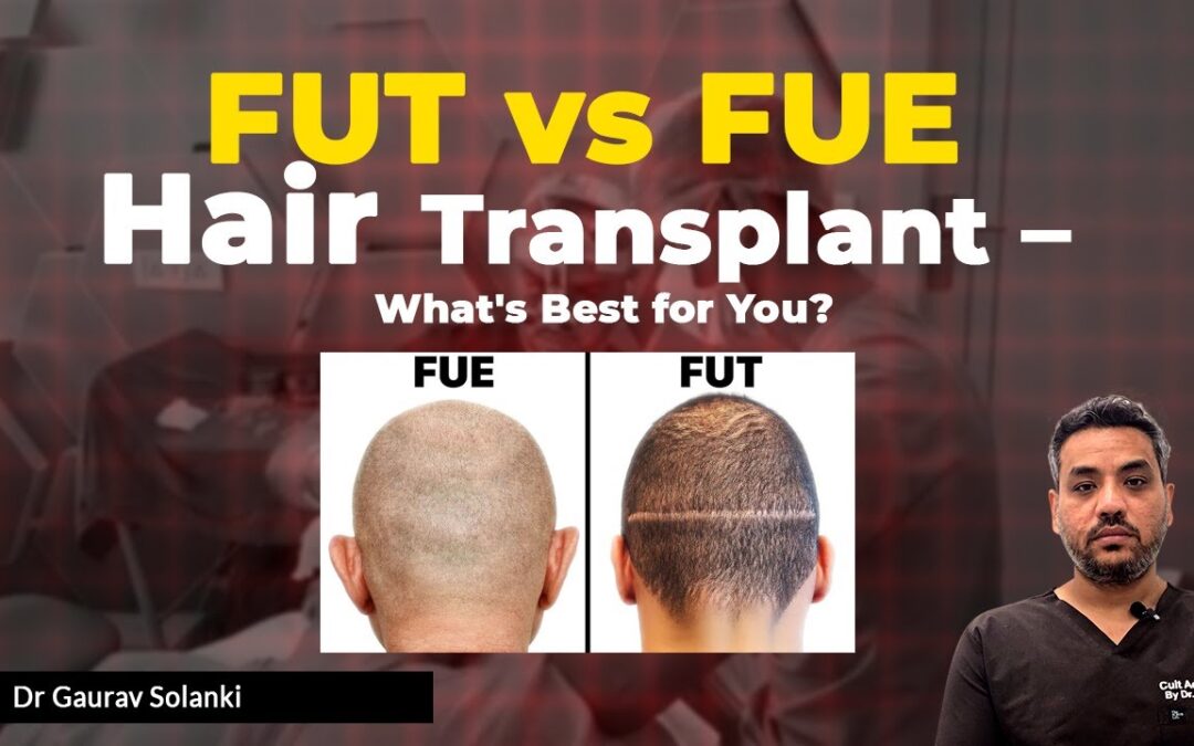 FUT vs FUE Hair Transplant: Which One Is Right for You?