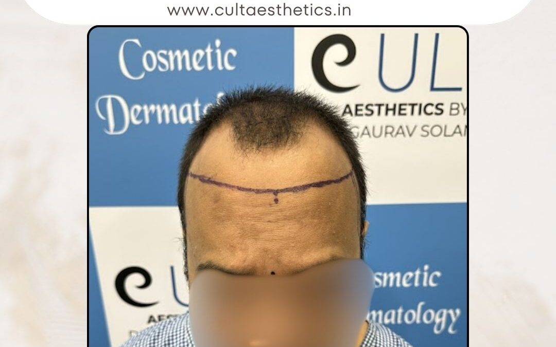 Hair Case 377 Before 1