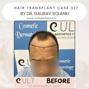 Hair case 377 Before-1