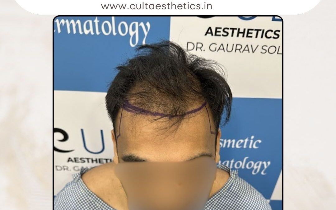 Hair Case 378 Before 1