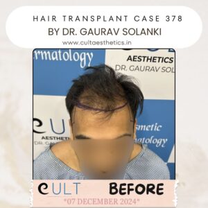 Hair case 378 Before-1