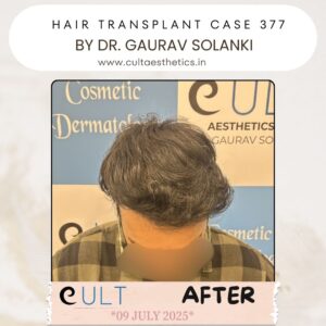 hair case 377 After-2