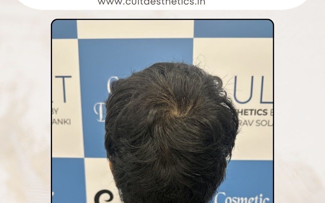 Hair Case 377 After 4