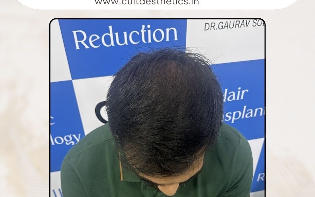 Hair Case 378 After 4