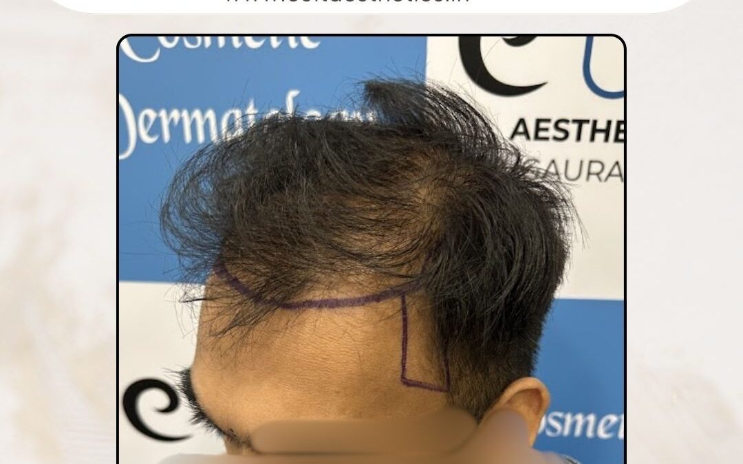 Hair Case 378 Before 3