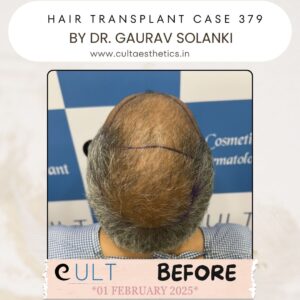 hair case 379 Before-3