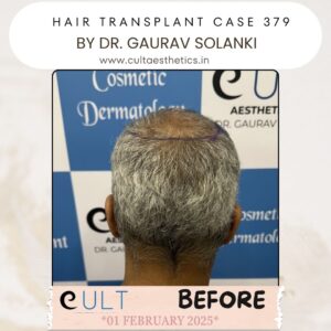hair case 379 Before-4