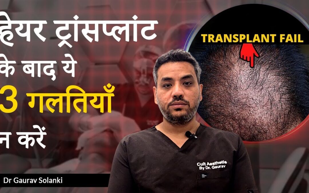 3 Mistakes to Avoid After Hair Transplant – Doctor’s Advice