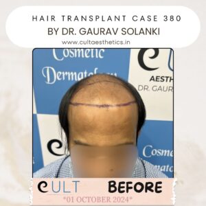 Hair case 380 Before-1