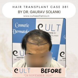 Hair case 381 Before-1