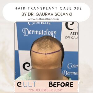 Hair case 382 Before-1