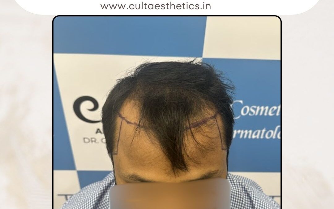 Hair Case 386 Before 1