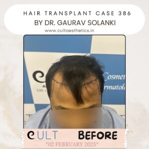 Hair case 386 Before-1