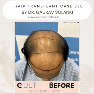 hair case 380 Before-2
