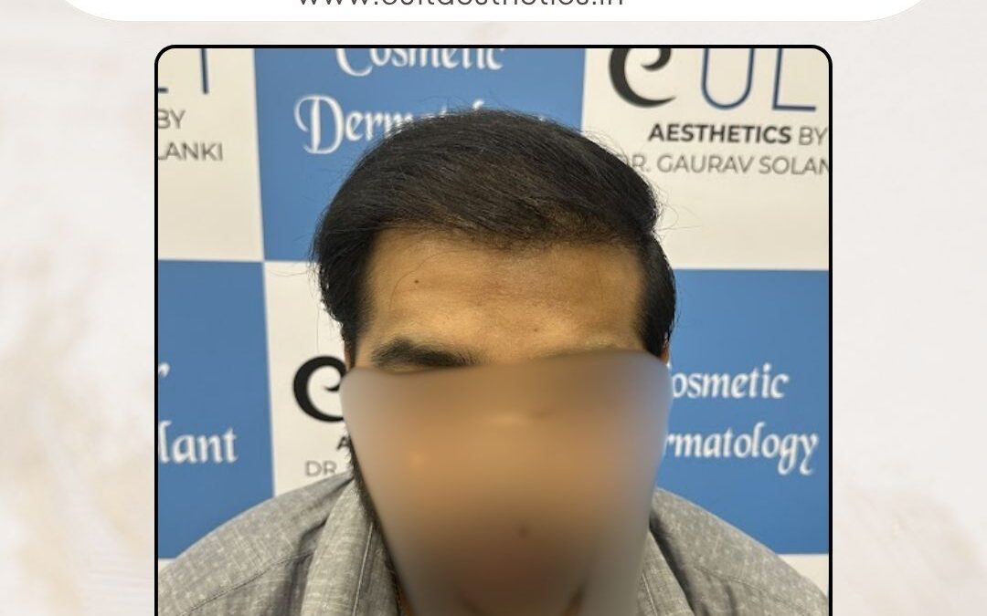 Hair Case 381 After 1