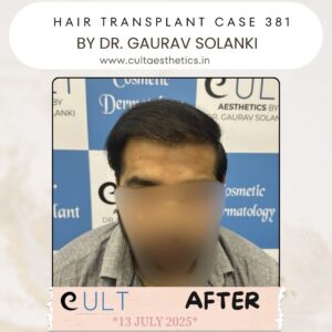 hair case 381 After-1