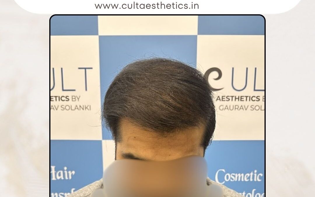 Hair Case 381 After 3