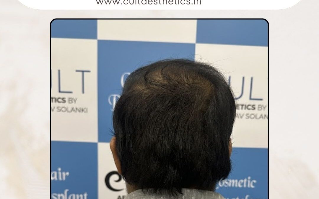 Hair Case 381 After 4