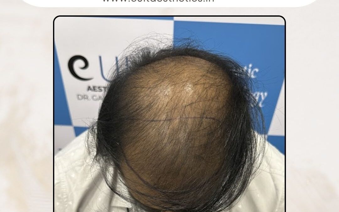 Hair Case 381 Before 2