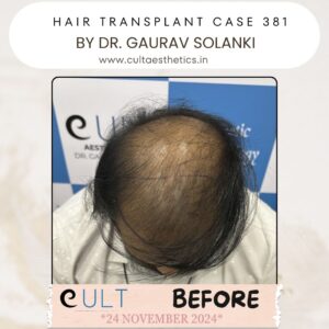 hair case 381 Before-2