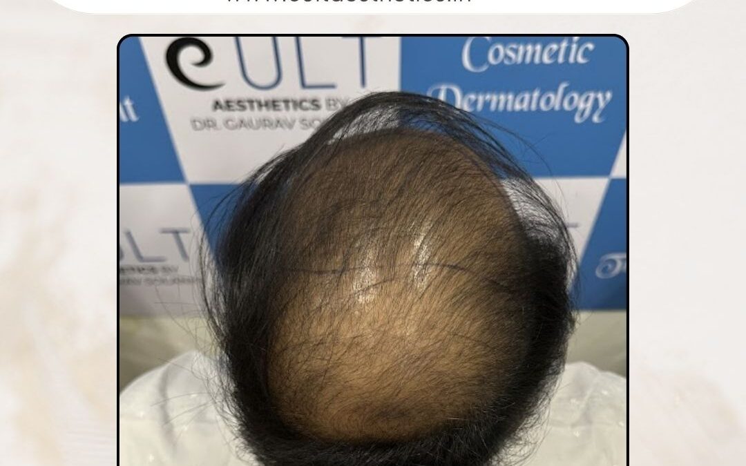 Hair Case 381 Before 3