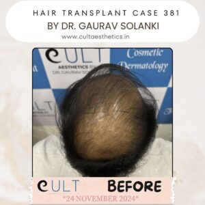 hair case 381 Before-3