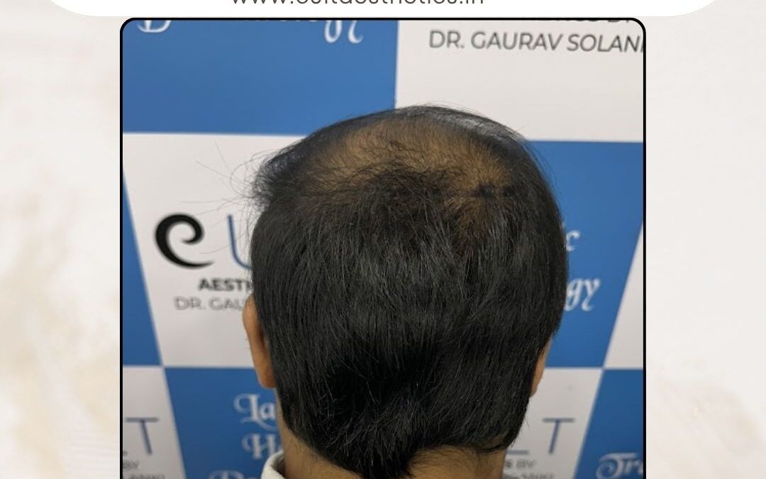 Hair Case 381 Before 4