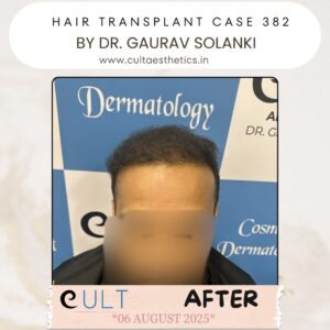 hair case 382 After-1