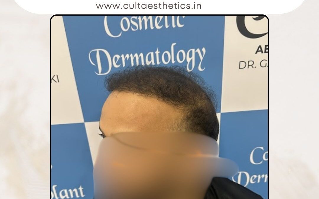 Hair Case 382 After 3