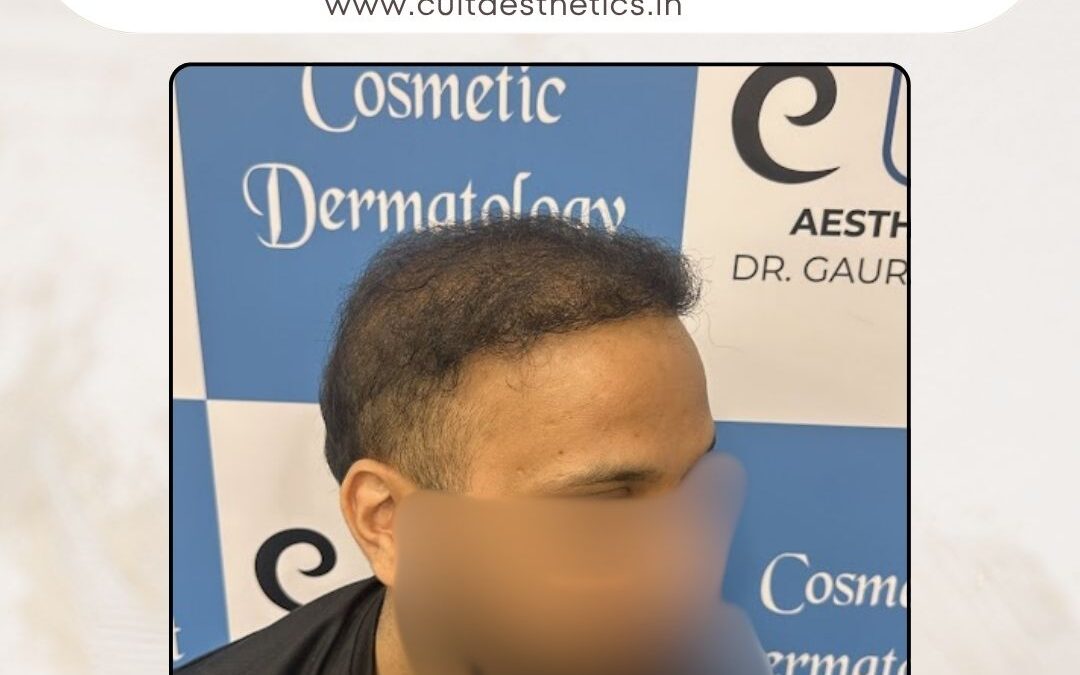 Hair Case 382 After 4