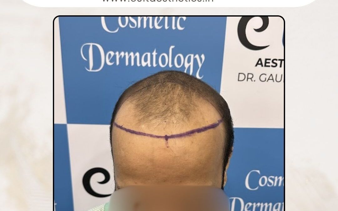 Hair Case 382 Before 2