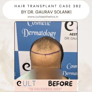 hair case 382 Before-2