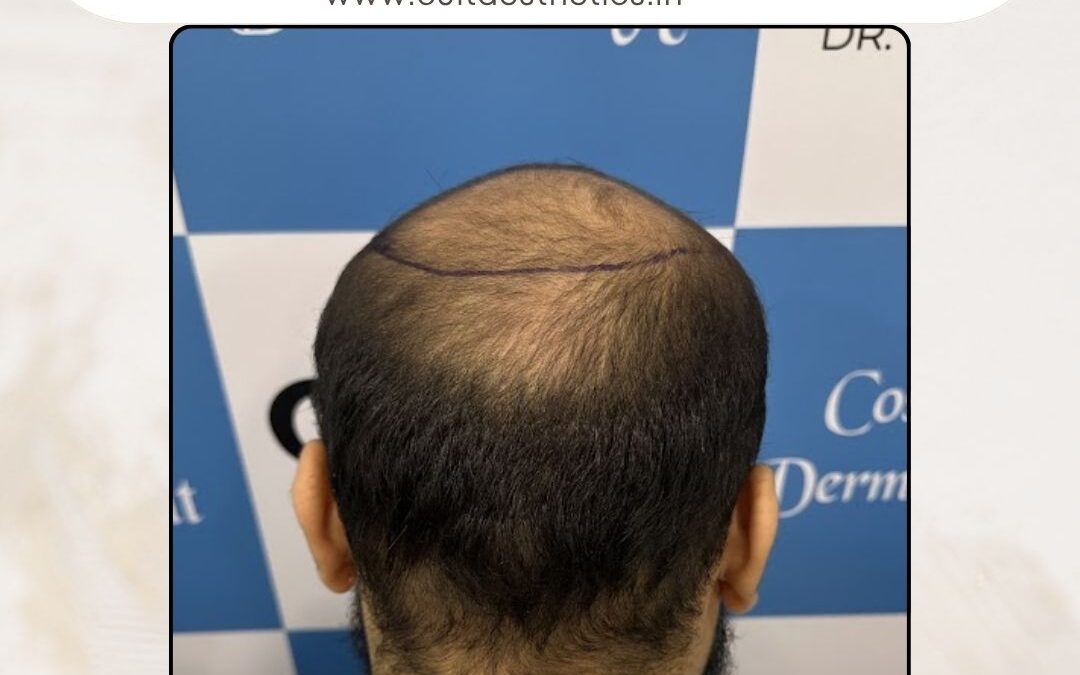 Hair Case 382 Before 4