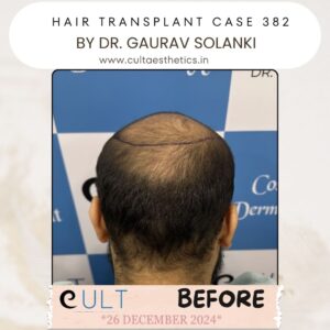 hair case 382 Before-3