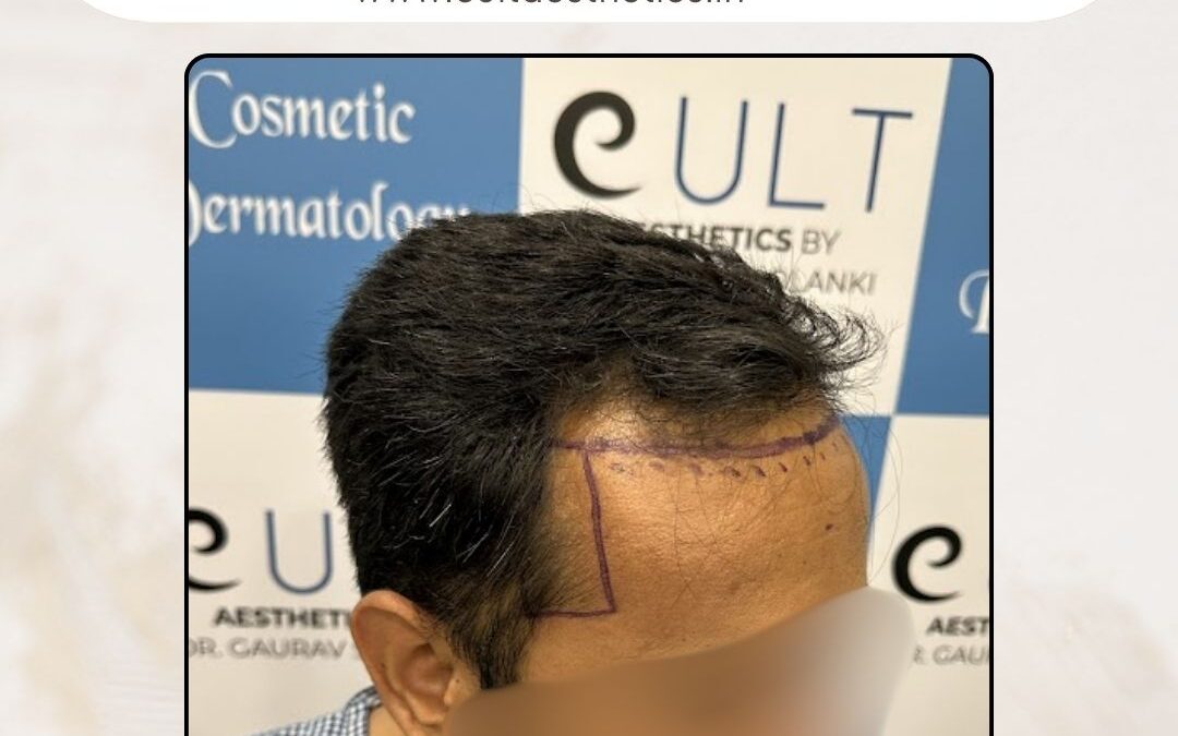 Hair Case 383 Before 3