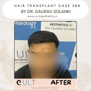 hair case 384 After-1