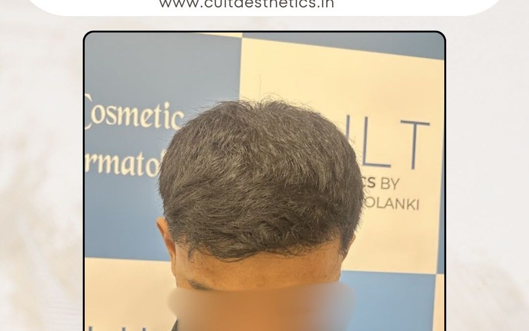 Hair Case 384 After 2