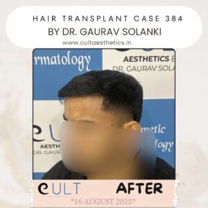hair case 384 After-4
