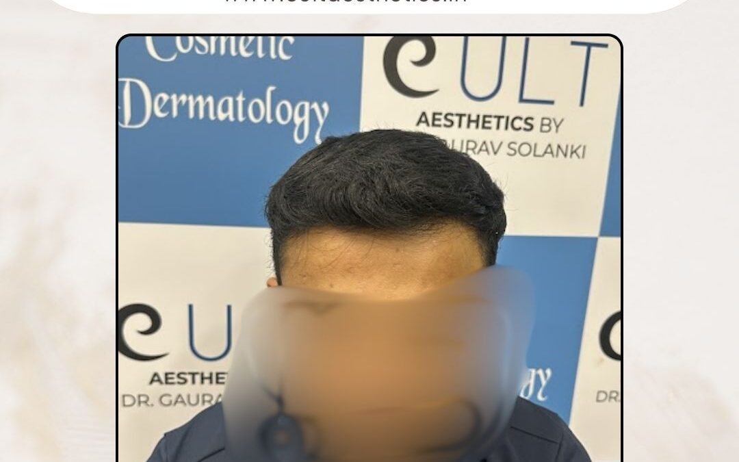 Hair Case 385 After 1