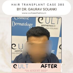 hair case 385 After-1