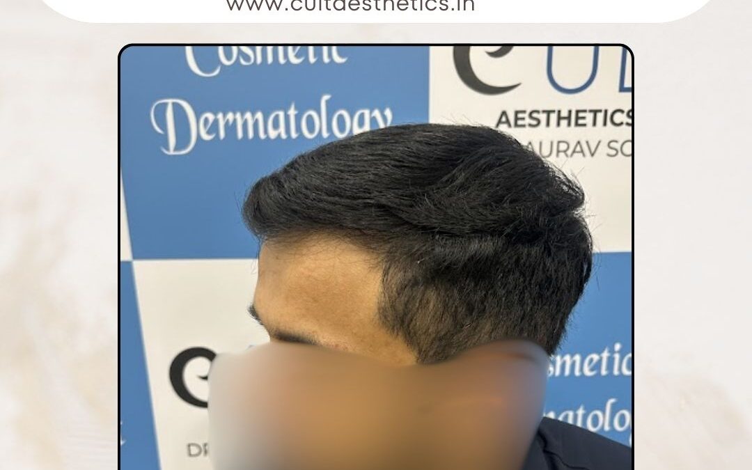 Hair Case 385 After 2