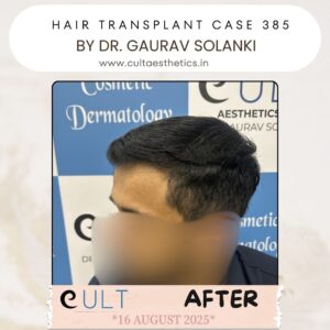 hair case 385 After-2