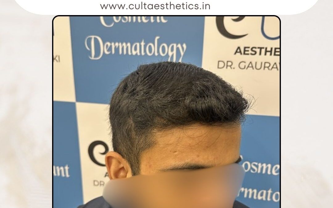 Hair Case 385 After 3