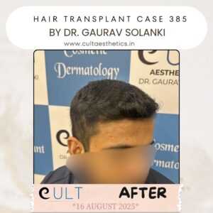 hair case 385 After-3