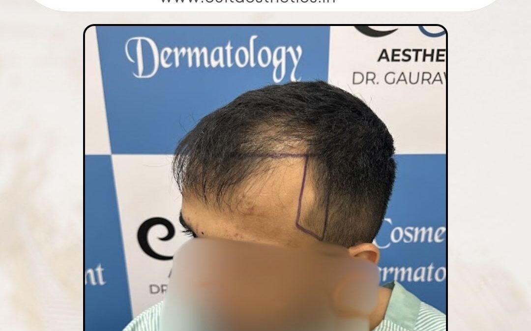 Hair Case 385 Before 2