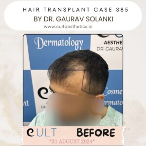 hair case 385 Before-2