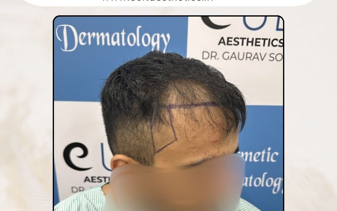 Hair Case 385 Before 3